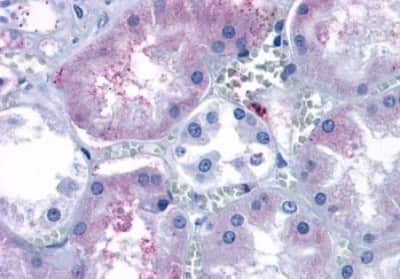 Immunohistochemistry-Paraffin: S1P3/EDG-3 Antibody [NBP3-14467]